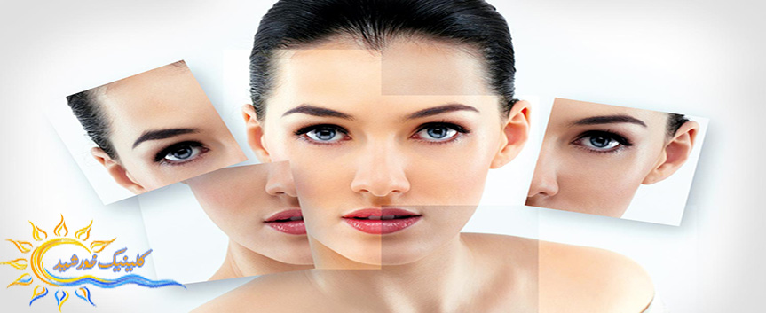 مراقبت های پوستی بعد از لیزر موهای زائد برای کاهش درد یا التهاب پوست