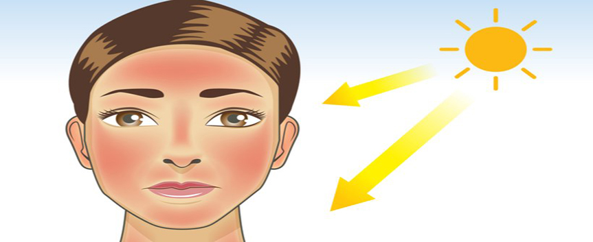 بهترین روش های درمانی موثر آسیب های پوستی ناشی از آفتاب سوختگی